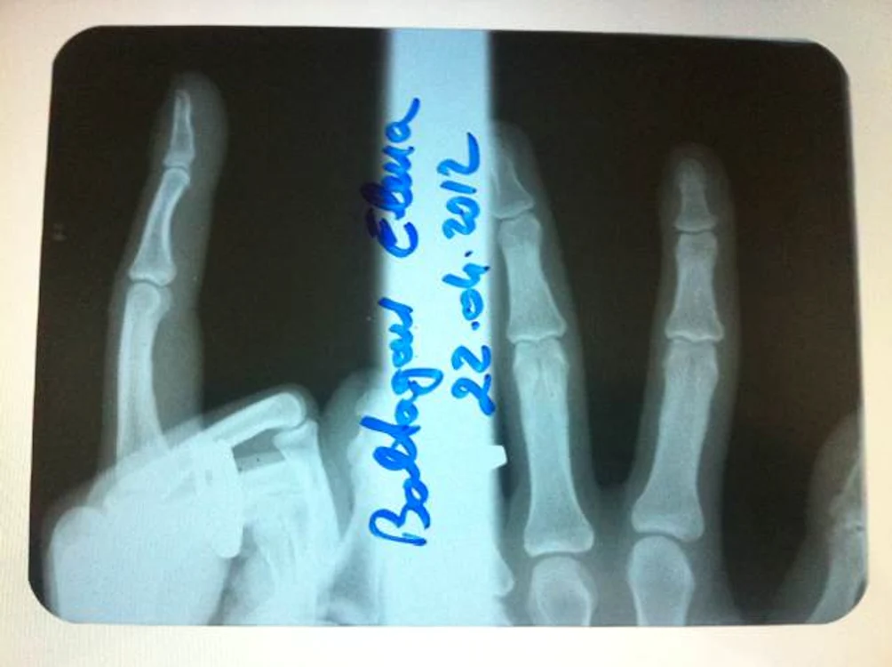 radiografie