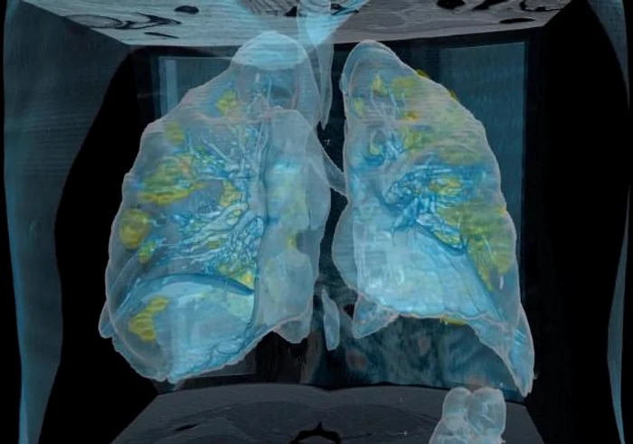 Sursa foto: Facebook