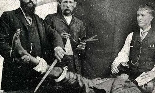 Faţa neştiută a progresului medical | FOTO jpeg