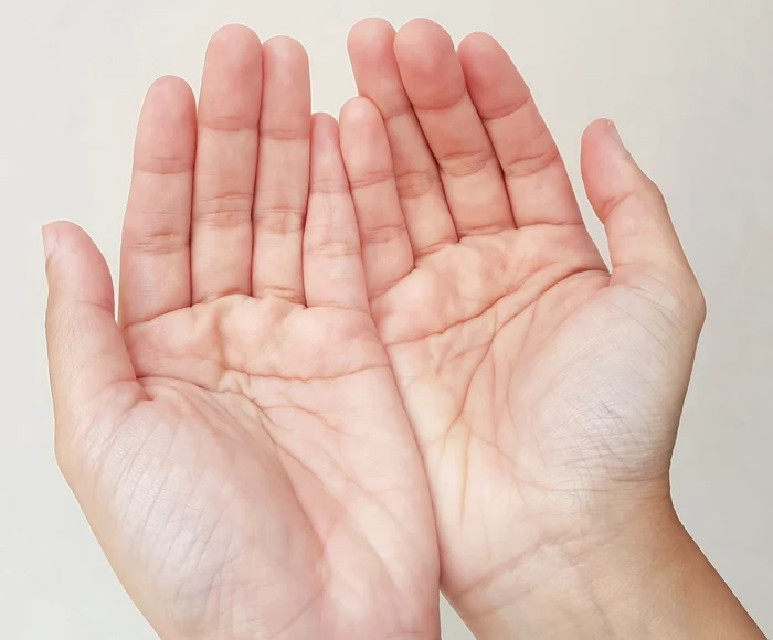 Bolile grave care se pot vedea în palme / foto: arhiva Click!