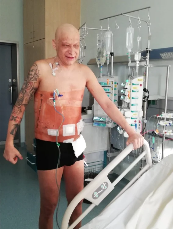 Boala l-a schimbat mult pe Ramon