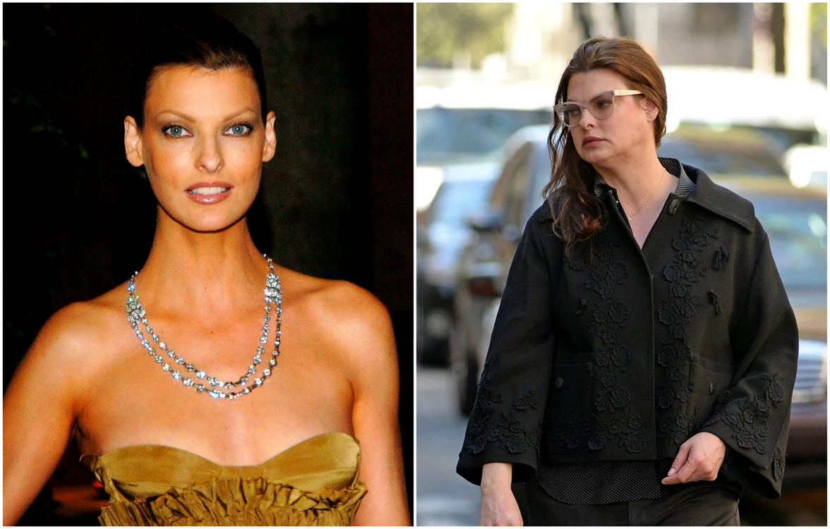 Linda Evangelista, desfigurată de o procedură estetică nereușită 