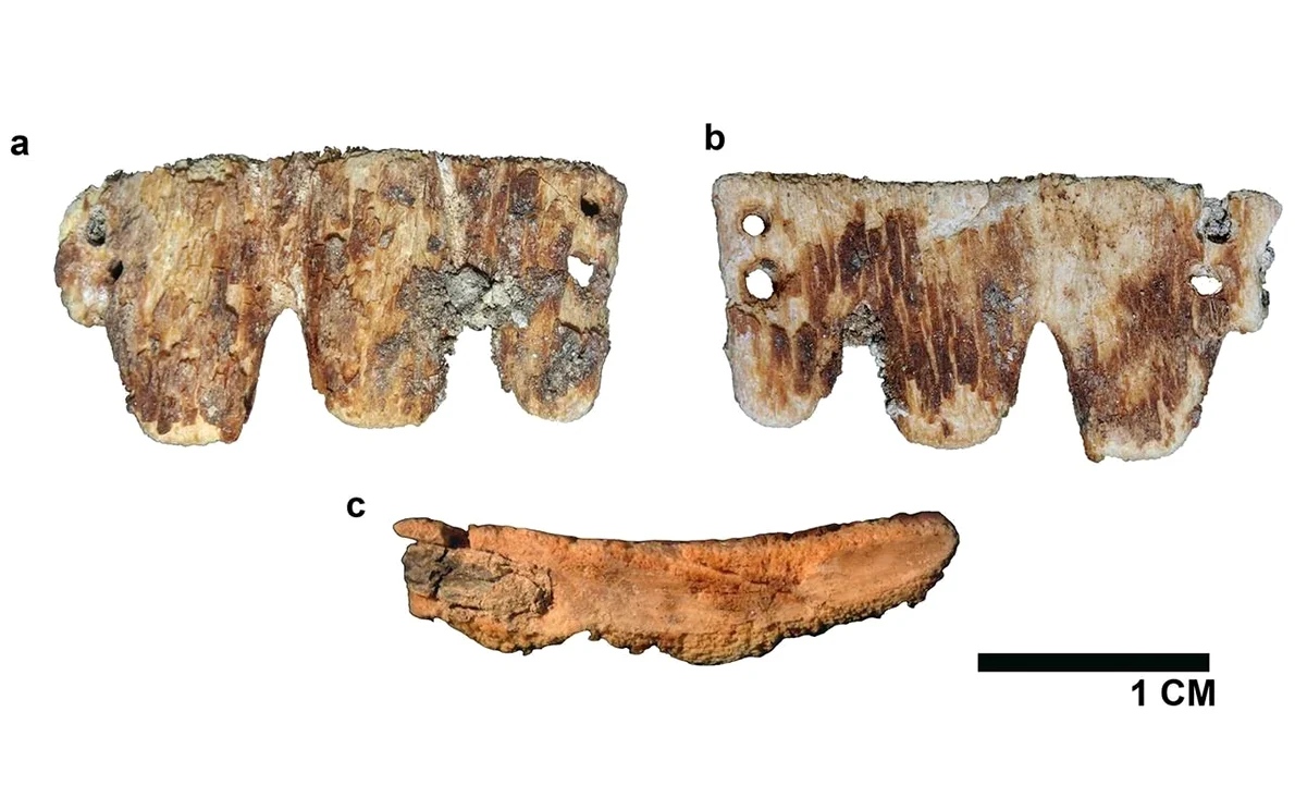 Puntea dentară din secolul al XIX-lea descoperită în Portugalia (© Vassallo et al., International Journal of Osteoarchaeology, 2026)