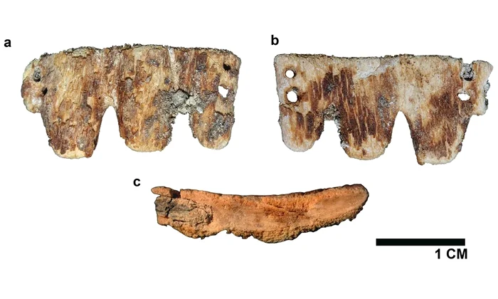 Puntea dentară din secolul al XIX-lea descoperită în Portugalia (© Vassallo et al., International Journal of Osteoarchaeology, 2026)