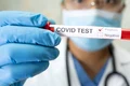 eprubeta covid-19