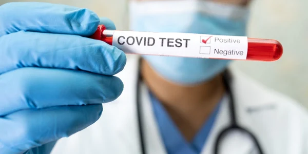 eprubeta covid-19