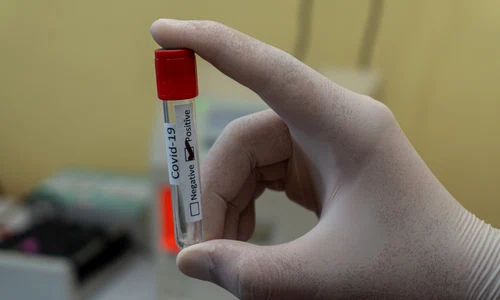coronavirus 24 ianuarie 2022 jpg