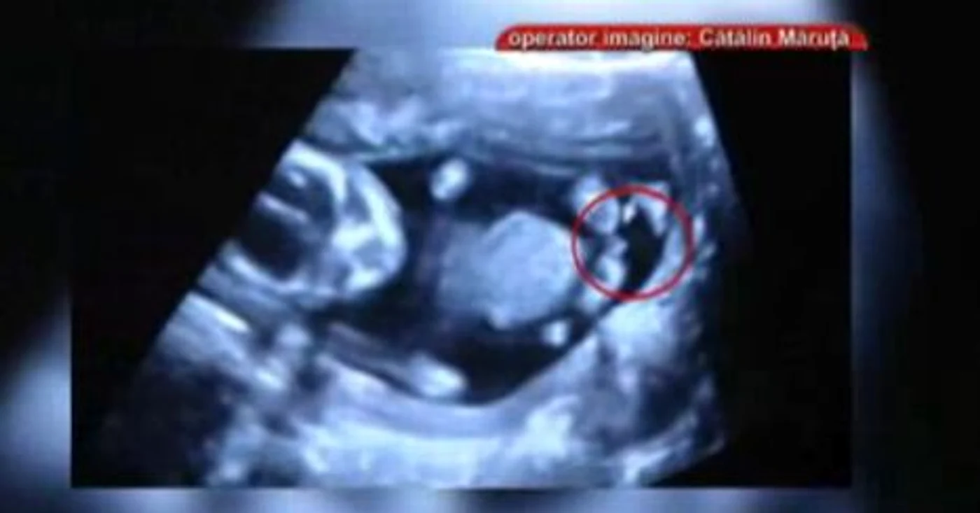Pepe va fi tătic (Foto: Captură video Pro TV)