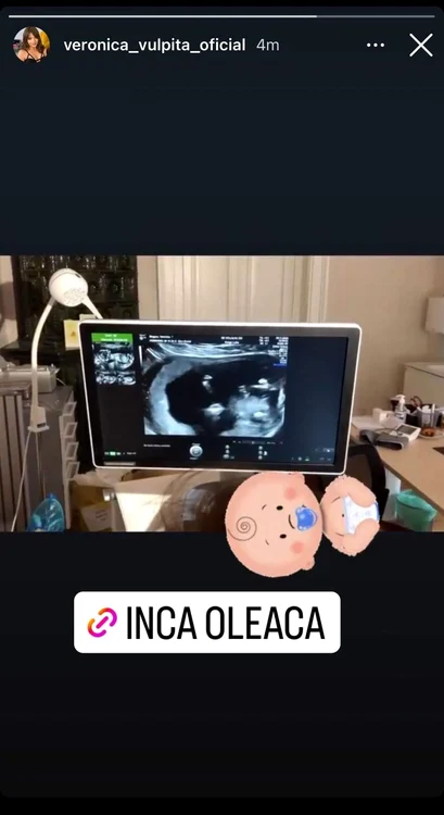Vulpița a anunțat pe Instagram că este din nou însărcinată / FOTO: Instagram