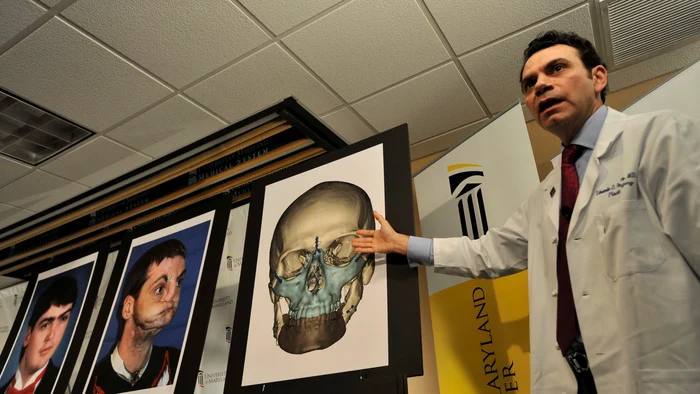 Medicul Sergio Canavero ar vrea să realizeze primul transplant de cap la Londra