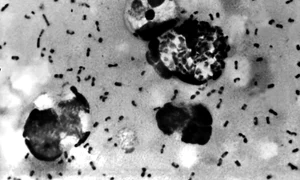 Ciuma bubonica FOTO Shutterstock jpg