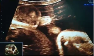 bebe face pipi in burta mamei jpeg