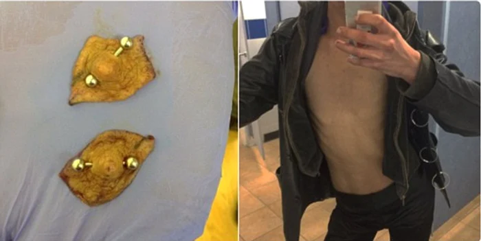 Și-a făcut cele mai stranii operații esteticeFoto Twitter