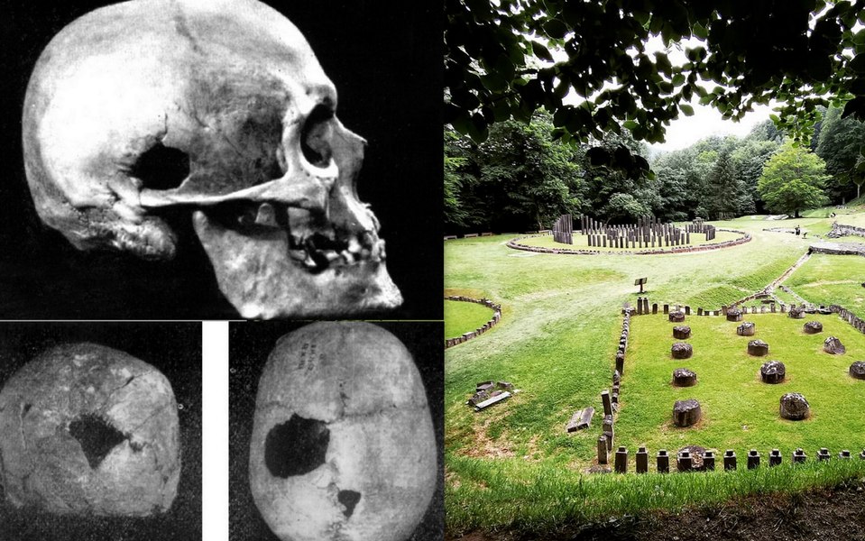 Dovezi uimitoare că anticii practicau chirurgia. Schelet cu craniul trepanat înhumat cu bisturiul în mână