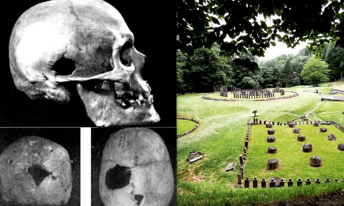 Cranii Trepanate  Foto Medicina in Dacia Horatiu Crisan (1) jpg