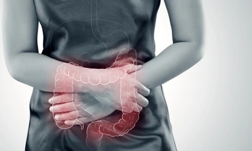 Ce este enterocolita jpeg