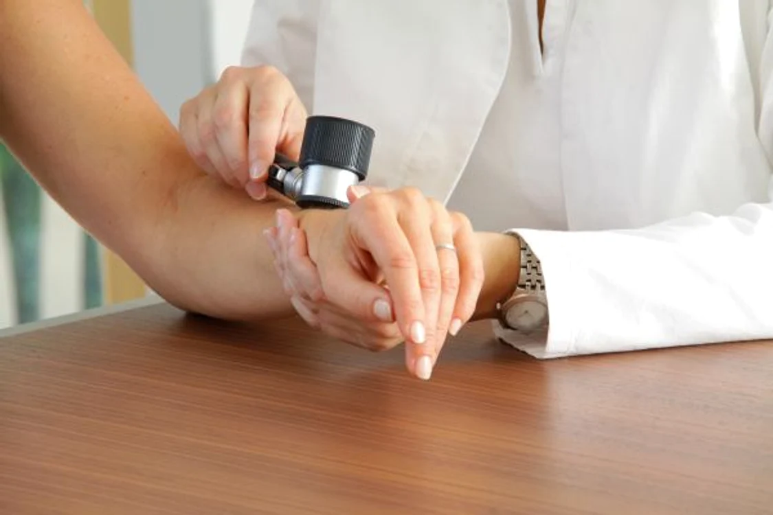 Este recomandat ca aluniţele atipice, care îşi modifica formă sau asupra cărora avem dubii să fie examinate de dermatolog. www.clicksanatate.ro