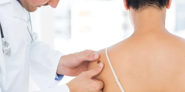 Alunita - dermatologie FOTO 123 RF 