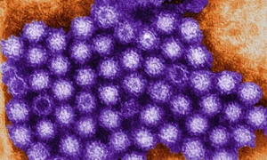 norovirus jpg
