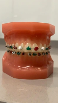 2 aparate de craciun jpg jpeg