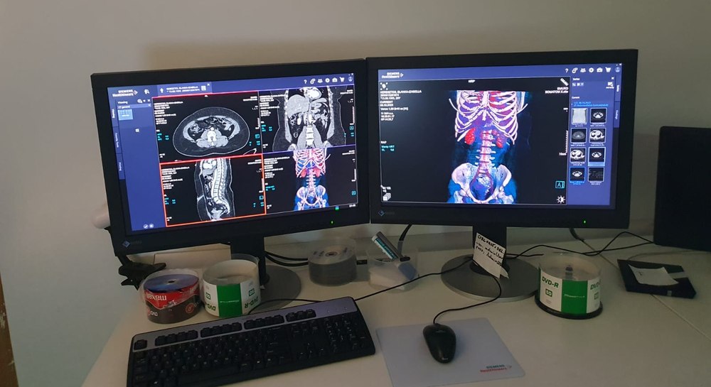 Computer tomograf modern la UPU SMURD Târgu Mureş: „Doza de radiaţii încasată de pacient este cu 50% mai mică”