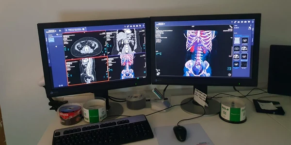 computer tomograf spital Mures jpg
