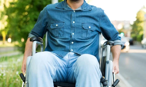 scleroza multipla jpg