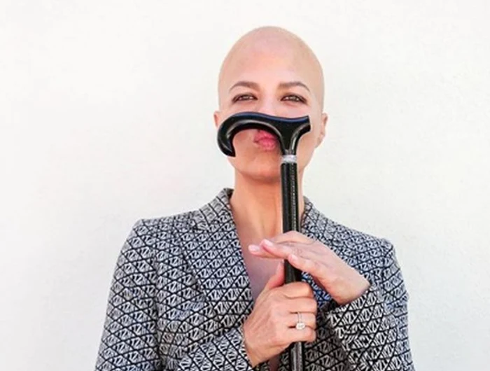 
    Selma a trecut printr-o serie agresivă de chimioterapie, în speranţa că boala ei va stagna Foto: Profimedia  