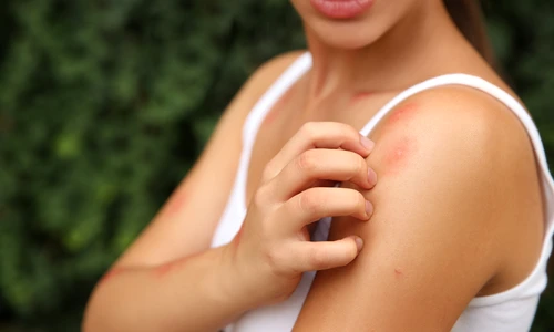 1 muscatura de tantar jpg jpeg