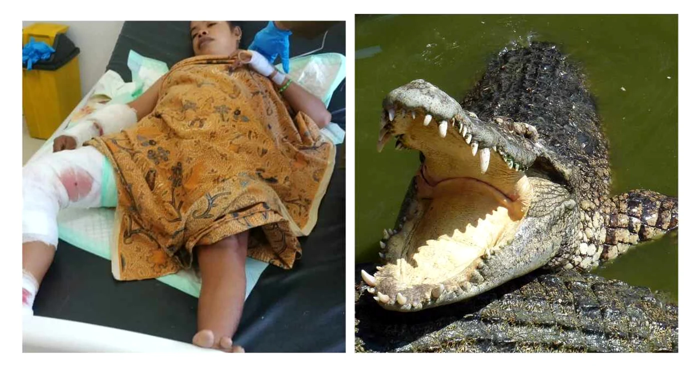 Falmira de Jesus, femeia din Indonezia atacată de crocodil