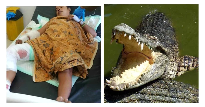 Falmira de Jesus, femeia din Indonezia atacată de crocodil