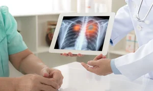 1 lung jpg jpeg