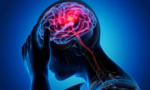 accident vascular cerebral jpg