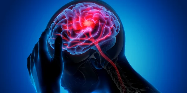 accident vascular cerebral jpg