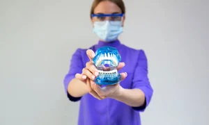 implant dentar (1) jpg