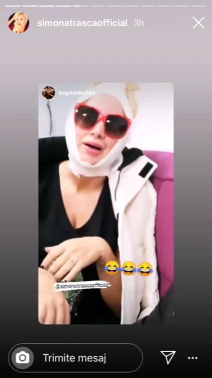 Așa arată Simona Trașcă după lipoaspirația la gușăfoto: Instagram