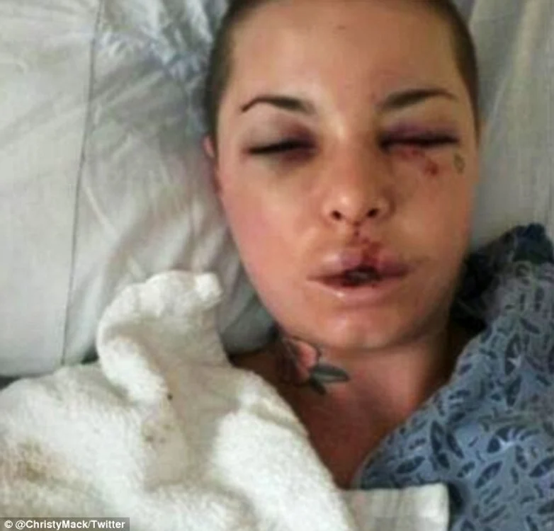 
    În urmă cu o lună şi jumătate, Christy Mack (23 de ani) era de nerecunoscutfoto: Twitter  