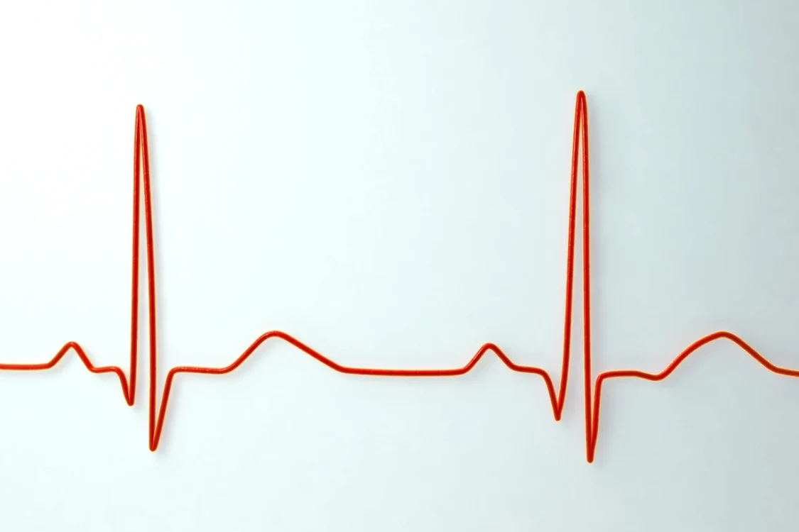 Puls ritm cardiac FOTO Getty Images