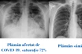 plaman diferente jpeg