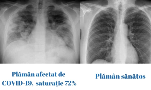 plaman diferente jpeg