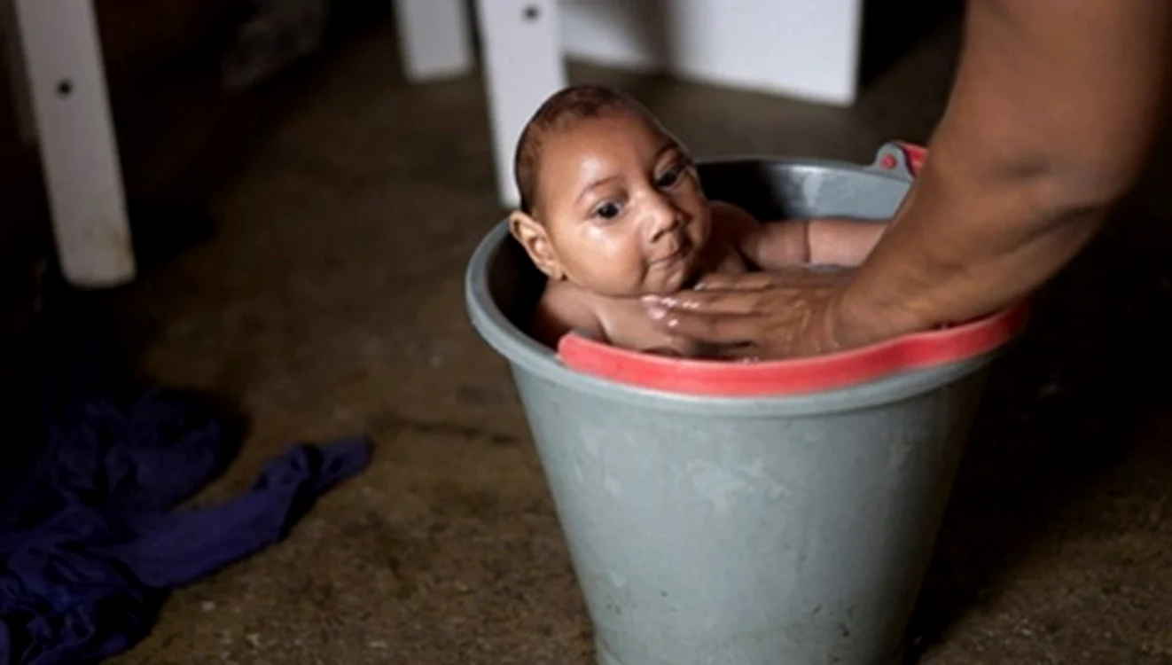 
    Copiii cu virusul Zika se nasc cu craniul deformatfoto: BBC  