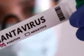 hanta virus jpg