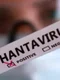 hanta virus jpg