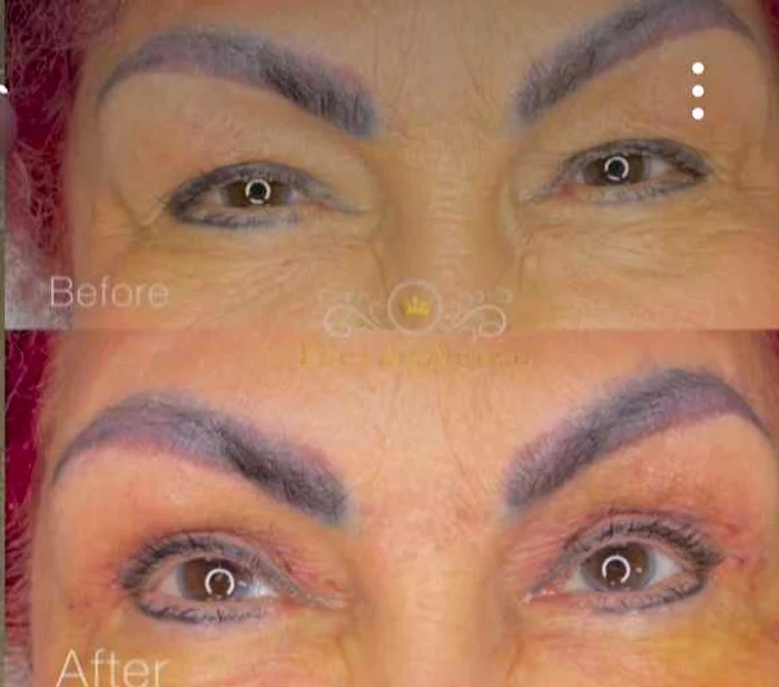 Artista a apelat la blefaroplastie superioară. FOTO Click
