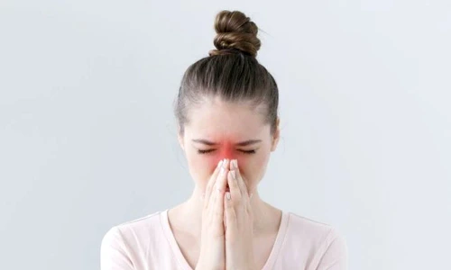 raceala covid alergie jpg