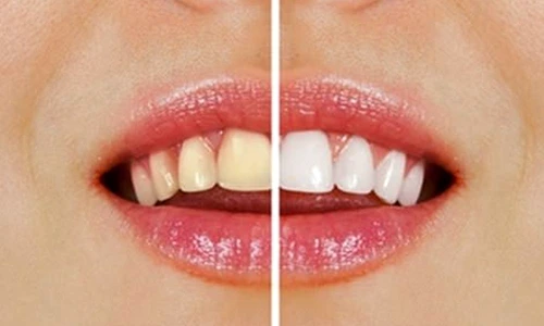 1 68655 original jpg jpeg