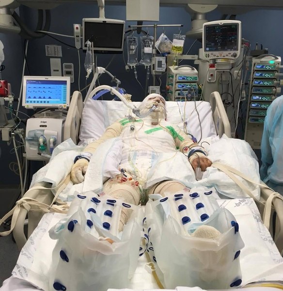 „Mă simt profund îndurerat și tulburat”. Managerul Spitalului Floreasca a reacționat la acuzațiile făcute de sora pacientei infectate cu Candida auris