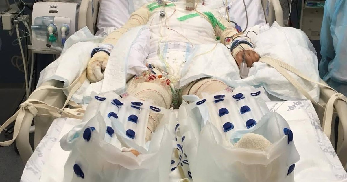 „Mă simt profund îndurerat și tulburat”. Managerul Spitalului Floreasca a reacționat la acuzațiile făcute de sora pacientei infectate cu Candida auris