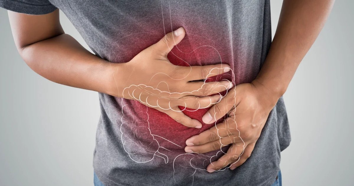 Rising Colon Cancer in Young People: Early Signs & Risk-Reducing Diet Strategies