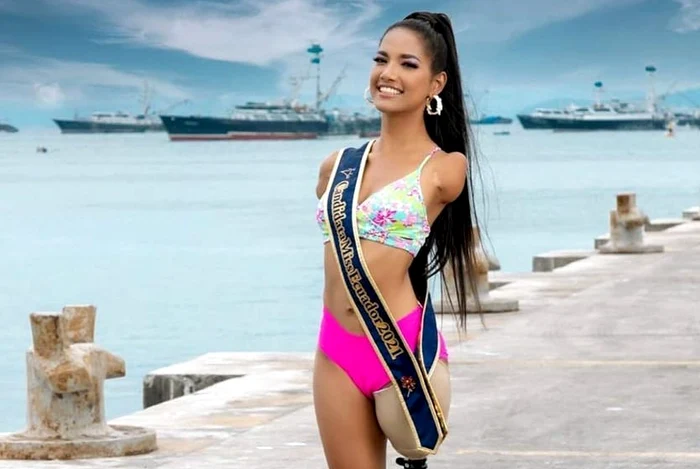 Victoria Salcedo a rămas fără mâini și fără un picior, la vârsta de 6 ani (Foto: Instagram)